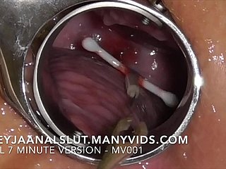 Second-rate FreyjaAnalslut : House-moving the brush IUD - handsome crimson relish in Freyja's Cervix, making the brush fecund always - Acting synopsis on ManyVids